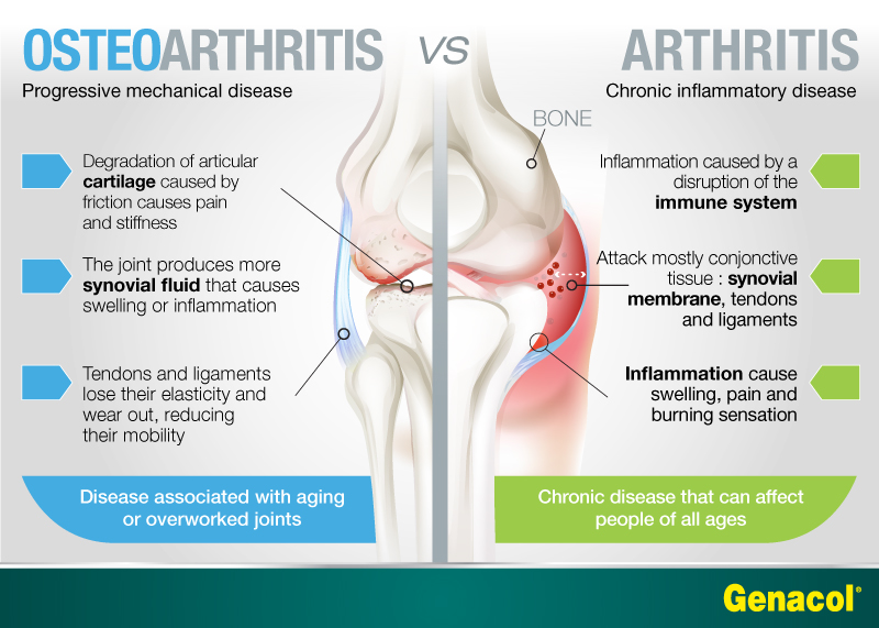 arthritis-or-osteoarthritis-good-times